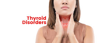 Thyroid Profile-I